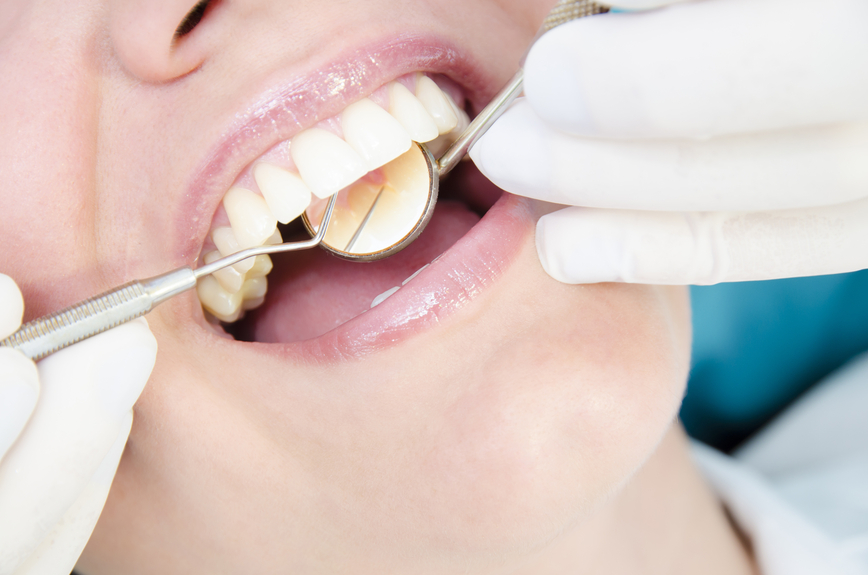 periodontal treatment teeth cleaning