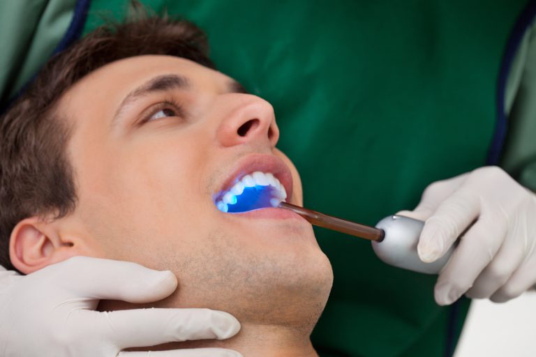 Teeth Whitening in Columbia & Glen Burnie, MD Maryland Family Dentistry
